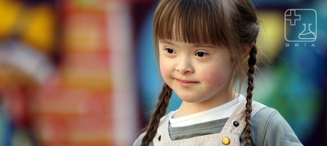 header-down-syndrome